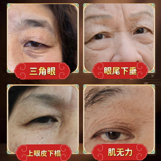 Miss Youya special eyelid lifting patch for middle-aged and elderly people, a magic device for relaxing eye muscles, weak eye size correction patch, invisible eyelid lifting patch for men and women, drooping eyelid lifting 200 patches, delivery, watering bottle + tweezers/tools
