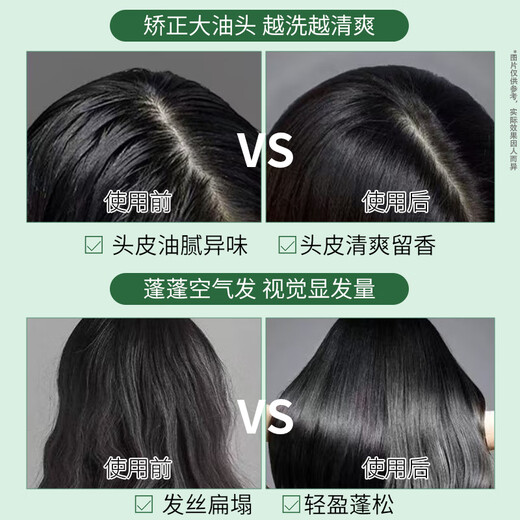 Shiseido Professional Hair Care Core Long-lasting Oil Control Restores Refreshing Hair without Makeup Fragrance Scalp Series Oil Control Shampoo 1L