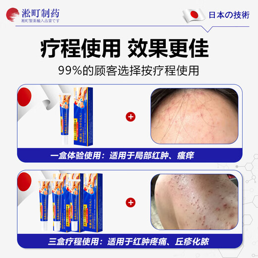 
Songcheng Pharmaceutical Folliculitis Pussy Loss Scalp Bacteria Folliculitis Folliculitis Folliculitis Fungal Infection