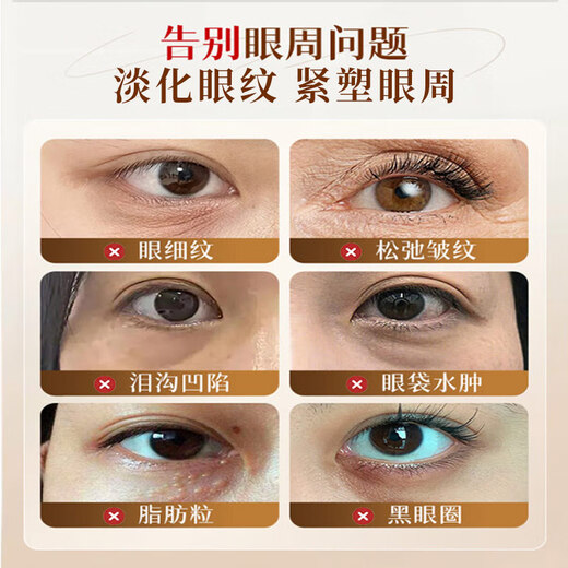 Baishu Astragalus Augencreme verdünnt feine Linien dunkle Kreise Augenbeutel Anti-