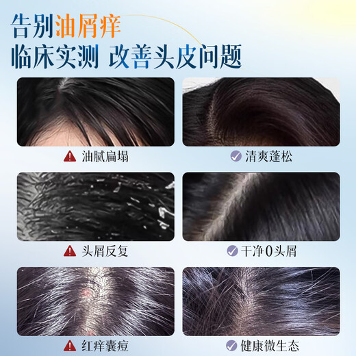 Vetes Shampoo Oil Control Anti-dandruff Anti-Itchy Fluffy Men and Women Long-lasting Fragrance No Silicone Oil Cleansing Shampoo Shampoo [JD Gold List] Oil Control Anti-dandruff Top List