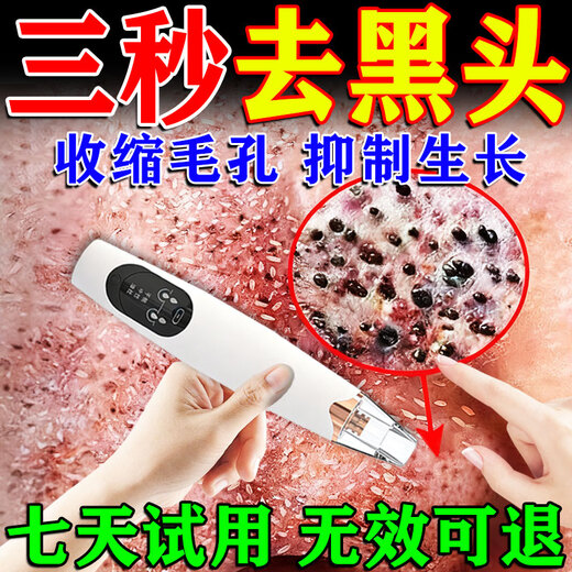 Qiaocheng blackhead suction instrument cleaner beauty salon special household large suction blackhead acne cleaning artifact for men and women white standard model vacuum negative pressure / suck out blackheads