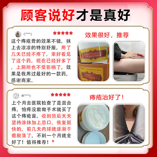Chicao Benhara Japan imported hemorrhoid cream to eradicate genuine i-meat ball artifact internal hemorrhoids and external hemorrhoids special plaster medical gel 100% special effect severe mole hemorrhoids a box of hemorrhoid cream to quickly reduce swelling, stop bleeding, relieve pain and treat hemorrhoids