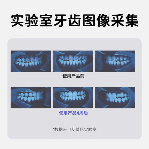 Ebonee German children's electric toothbrush 4-6-12 years old primary school students holiday birthday gift soft-bristled smart sonic toothbrush anti-moth and gum protection C1S pink national subsidy