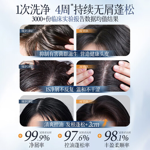 韩方五谷二硫化硒洗发水去屑止痒控油蓬松洗头膏露男女士500ml第一名