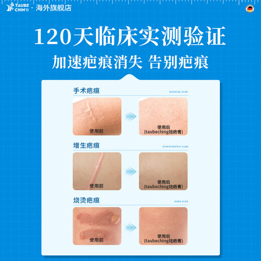 TaubeChing German original scar removal cream for scar removal and repair, medical silicone proliferative bumps to remove pimples, 4 boxes of periodic packaging, burns and scalds/surgery/hyperplastic scars