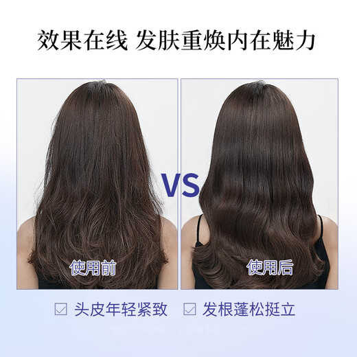 Shiseido Professional Hair Salon Care Dochuangxin -Technologie stärkt die Wurzel und stärkt Haare, Bulain Lin, Kopfhaut -Vitalitätsserie Shampoo 1L