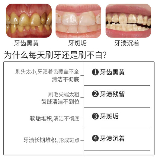 SOAO中硬毛高级牙刷男士专用去牙渍清洁烟渍成年人 特硬礼盒套装