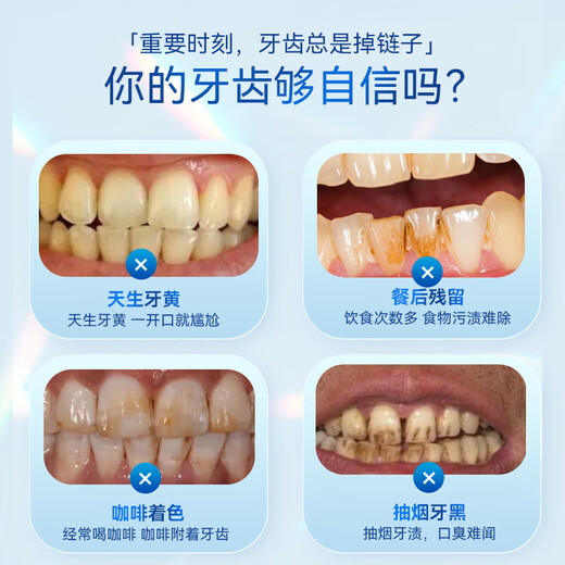 SMILEKIT Whitening Teeth Strips, Teeth Whitening Remove Yellow, Whiten and Brighten Teeth Stains, Remove Stains, Portable Sparkling White Teeth Whitening Strips, 1 box trial pack [7 pairs of 14 patches]