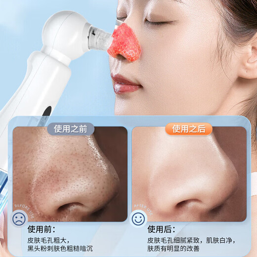AUX blackhead suction instrument, special small bubbles for beauty salons, household large suction electric cleaner, pore cleaning and hydration, facial blackhead cleaning, acne removal tool, beauty instrument, fully equipped with hot compress model, gentle water suction + four-speed mode + deep cleaning AUX X20 small bubbles (A white)