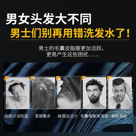 Schwarzkopf men's oil control and anti-dandruff shampoo 450ml (deep cleansing, refreshing oil control) shampoo