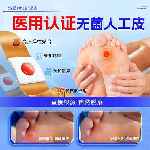 同仁堂鸡眼贴护理盒 鸡眼膏手部去脚后肉刺刺猴疣无刺痛脱落 三盒装