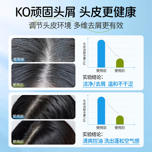 Masata Singapore imported youth shampoo oil control fluffy anti-dandruff anti-itch shampoo children adults men and women