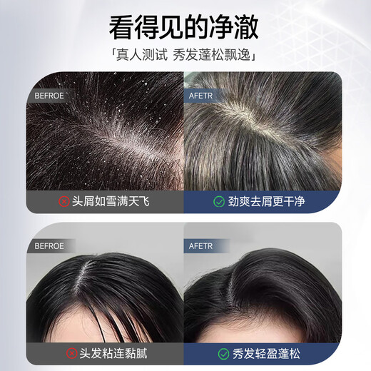 Flexible [Same Model for Fan Chengcheng] White Truffle Shampoo, Anti-dandruff Care, Removal Oil, Shampoo, Cleaning and Moisturizing Shampoo