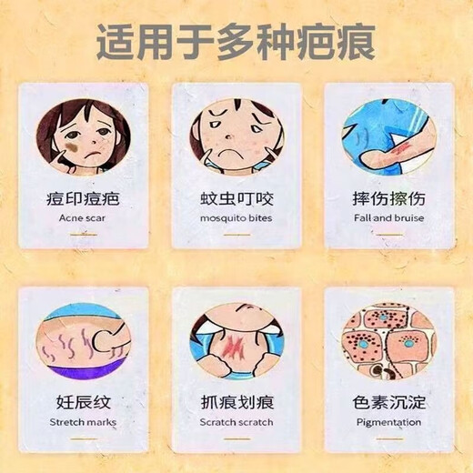 SUBIDE version German version SUBEX imported from Germany SUBEX gel German SUBEX scar gel original care contractubex SUBEX 1 trial pack, 30g each