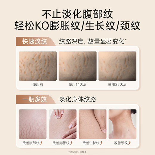 Kangaroo Mom Pregnant Women's Pregnancy Oil Double Extract Wrinkle Care Essence Cream Gift Box to Dilute Body Lines Olive Oil Skin Care Set