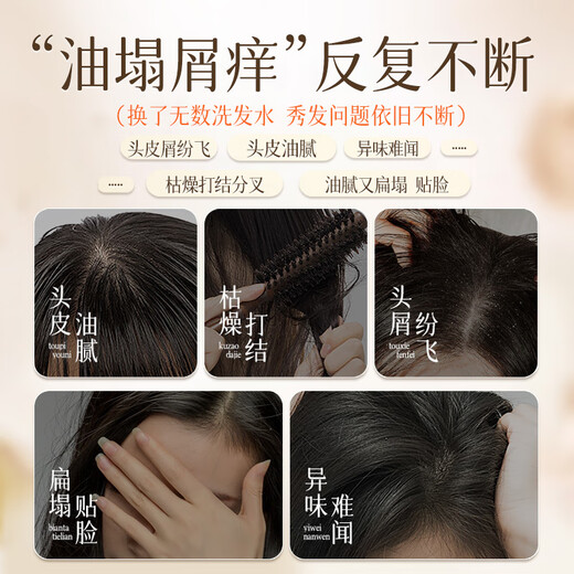 Beai Caviar Aminoácidos Champú Aceite Control Anti-Dandruff Fluffy Fragant Soft y Flush Champú para hombres y mujeres
