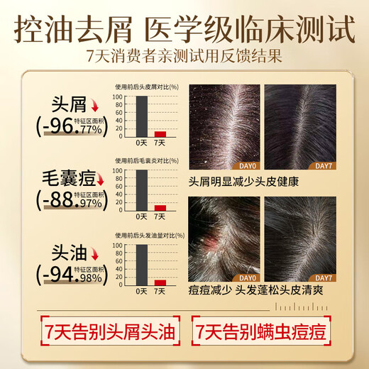 MUESRGTEI Pang Donglai Shampoo Anti-dandruff Anti-Itch Control Oil Long-lasting Fluffy Remaining Fragrance Special Shampoo for Men and Women