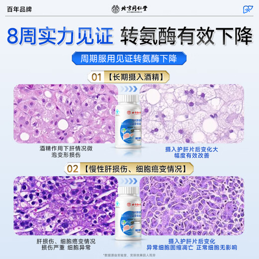 同仁堂养肝护肝片护肝胶囊脂肪葛根黄芪护肝片女男士喝酒肚子大肝不好