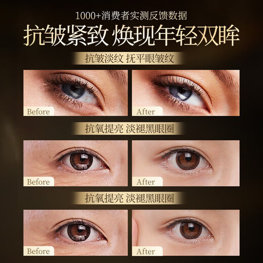 Aromat Herbs Australian imported eye essence oil 30ml anti-wrinkle, lightening fine lines, removing dark circles, eye bags, firming and skin care around the eyes