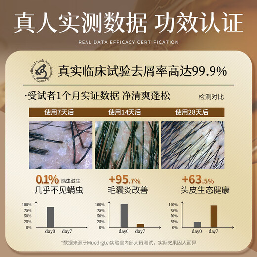 MUESRGTEI Pang Donglai Shampoo Anti-dandruff Anti-Itch Control Oil Long-lasting Fluffy Remaining Fragrance Special Shampoo for Men and Women