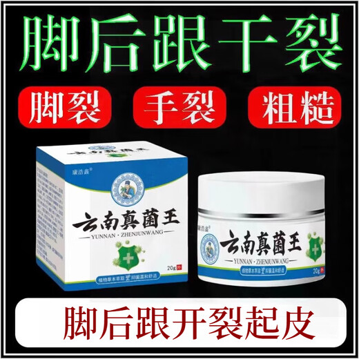 Yunnan Fungus King's Official Flagship Authentic Anti-Cracking Cream for Dry and Cracked Heels with Rough and Hard Skin on Hands and Openings 49% of Customers Choose 2 Bottles