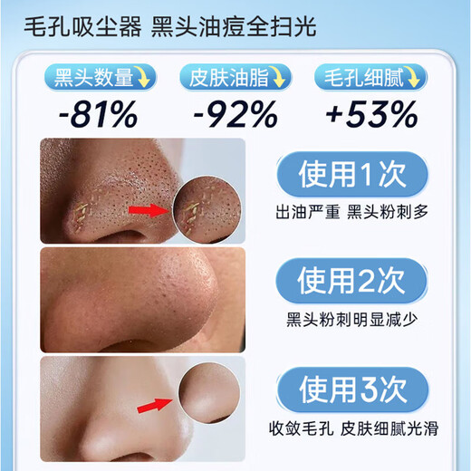 Xu Lin Germany blackhead suction instrument artifact super suction cleaner electric blackhead suction and acne shrinking pores household small bubble beauty instrument acne removal artifact upgraded and fresh style blackheads and acne can be solved with one suction