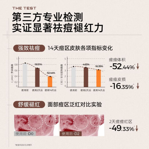 
C coffee acne removal cream colloidal sulfur acne fading redness closed mouth acne soothes oil to improve oil acne skin fading acne marks SN9767 [targeted acne removal] colloidal sulfur acne removal cream 15g