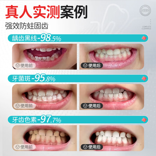 Masata新加坡进口儿童牙膏0-3-6-12岁专效防蛀固齿宝宝含氟牙膏龋齿50g