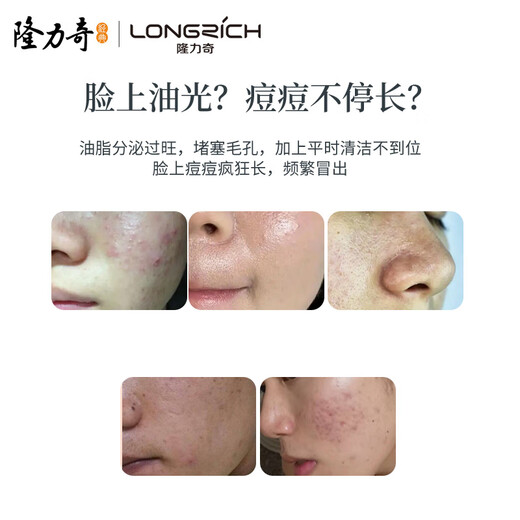 Longrich Multi-effect Sulfur Oil Control Cleansing Mud Deep Cleansing Oil Control Moisturizing Acne Remover Soothing Skin Unisex 100g*2 Count