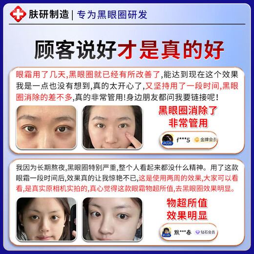 欧诱眼袋霜去大眼袋严重中老年专用消除重度男女士眼袋祛去除神器贴膜 1盒【严重黑眼圈】多买多送 提拉紧致抗皱淡化黑眼圈第一名