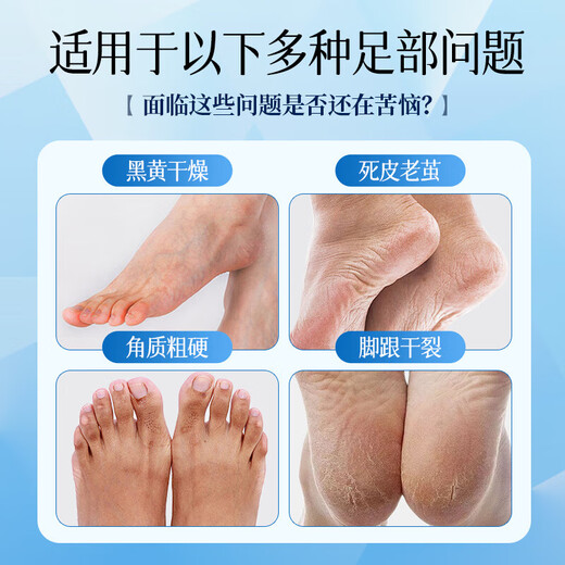 KOOGIS Vaseline moisturizing and repairing foot mask 40g foot mask to remove dead skin, exfoliate and rejuvenate feet, cracked heels