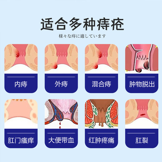 ASHK Hemorrhoid Cream eliminates hemorrhoids, removes the inside and outside of the ball, mixes hemorrhoid medicine, anal itching, no odor 15g*3 boxes