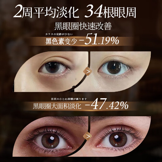 同仁堂抗皱眼霜提拉紧致抗皱淡化黑眼圈保湿修护抗衰老提亮眼周暗沉眼霜 1瓶 【淡纹紧眸 焕亮眼周】