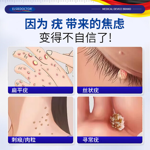 
ELSIEDOCTOR Pharmaceutical Wart Removal Cream Flat Warts Special Plantar Warts Acupuncture Warts Silk Warts Warts Spirit Neck Small Meat Neck