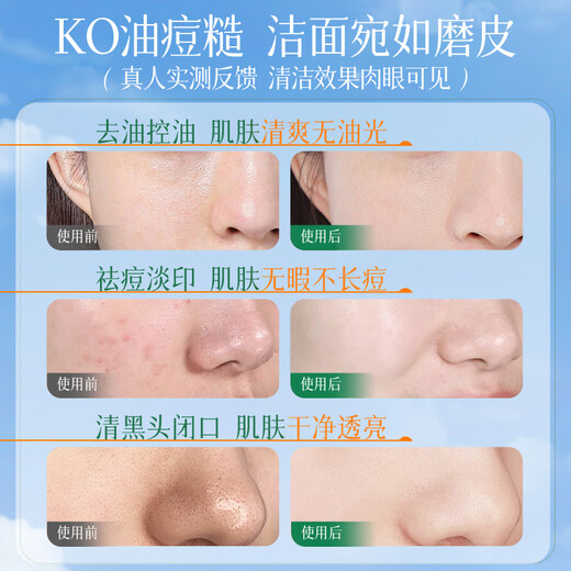 Korean Grain Amino Acid Facial Cleanser for Men and Women Oil Control Acne Removal Whitening Deep Cleansing Blackhead Skin Care Products Facial Cleanser No. 1