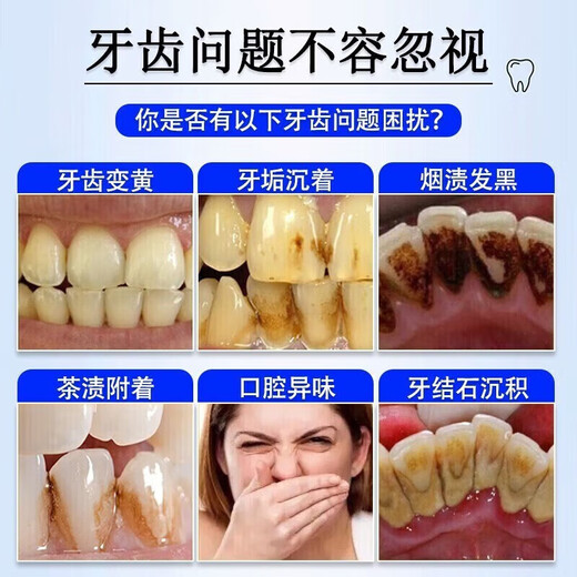 Nanjing Tongrentang whitening toothpaste removes bad breath, removes yellow tooth stains, removes tea and tobacco stains, freshens breath, cares for gums, top ten well-known brands, three boxes, suitable for yellow teeth, tooth stains, tobacco stains