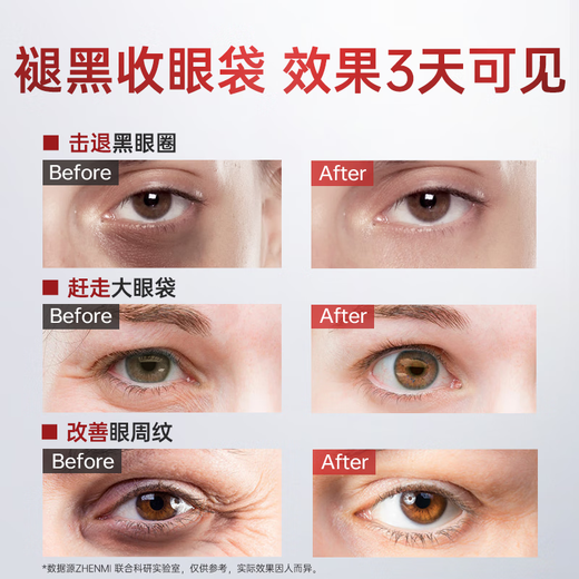 ZHENMI Singapore imported eye mask patch eye bags, lifting, firming, anti-wrinkle, diluting dark circles, severely removing eye bags for men and women