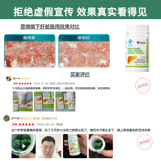 仁和护肝胶囊护肝片新态牌玉米葛根枳椇子胶囊*5养肝护肝排毒烟酒常备