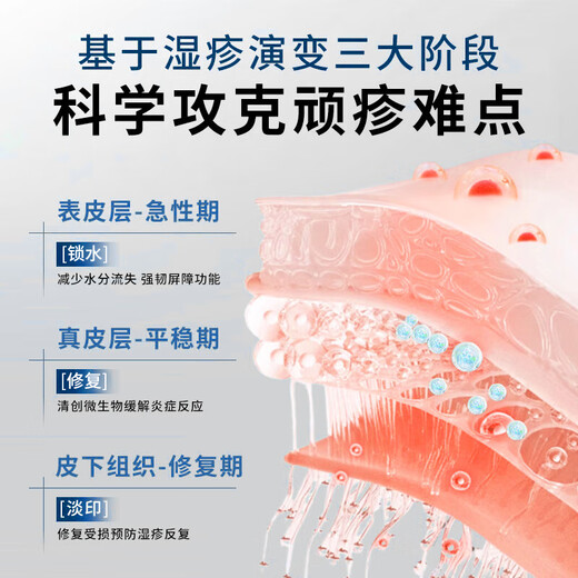 XIBELAON Germany specializes in eczema ointment eczema itchy skin dermatitis dermatitis fungal infection antipruritic cream special gel