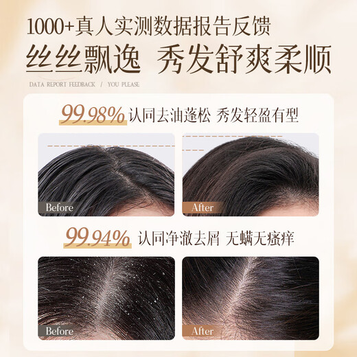 Beai Caviar Aminoácidos Champú Aceite Control Anti-Dandruff Fluffy Fragant Soft y Flush Champú para hombres y mujeres