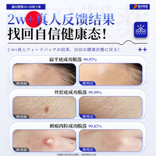 
Fujita Pharmaceutical Wart Removal Body Loss Flat Warts Special Stream Warts Genital Warts Plantar Warts Wart Removal Neck Neck 1 Box