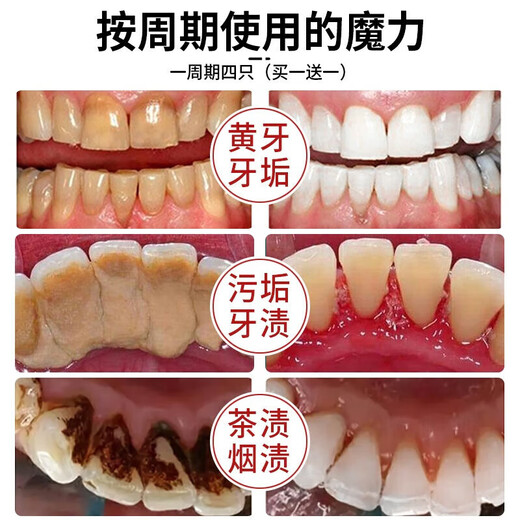 Nanjing Tongrentang whitening toothpaste removes bad breath, removes yellow tooth stains, removes tea and tobacco stains, freshens breath, cares for gums, top ten well-known brands, three boxes, suitable for yellow teeth, tooth stains, tobacco stains
