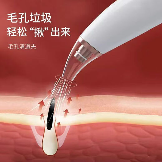 Qiji Blackhead Cleaning Magic Powerful Suction Beauty Salon Special Suction Instrument Nose Remover Acne Electric Facial Cleansing Instrument Beauty Basic Version 6 Suction Heads + Blackhead Remover