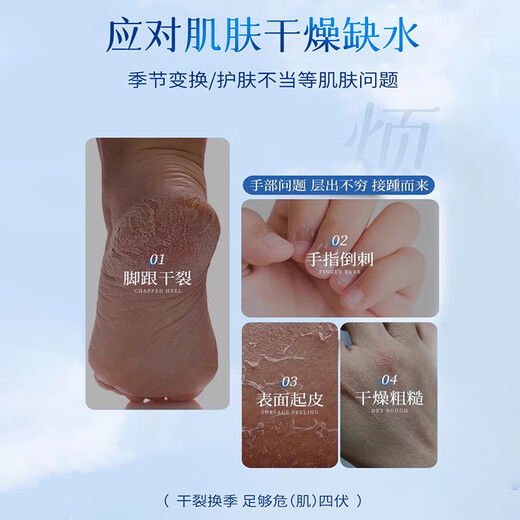 Baiyunshanwei E urea cracked rod foot crack cream heel dry crack crack anti-crack cream to improve rough hand and foot hand cream 30g