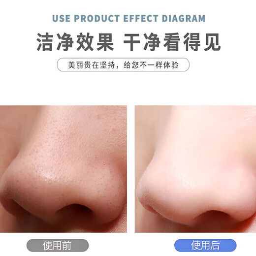 Sawang Instrumento de espinilla profesional alemán para absorber espinillas, pequeñas burbujas, poros y limpiador profundo de acné, removedor de espinillas eléctrico, succión súper fuerte, pequeñas burbujas, instrumento de belleza para circulación de agua, versión exclusiva, vibración ultrasónica + estiramiento profundo EMS + eliminación de espinillas/limpieza facial, vibración de alta frecuencia de 100 W, limpieza profunda de poros