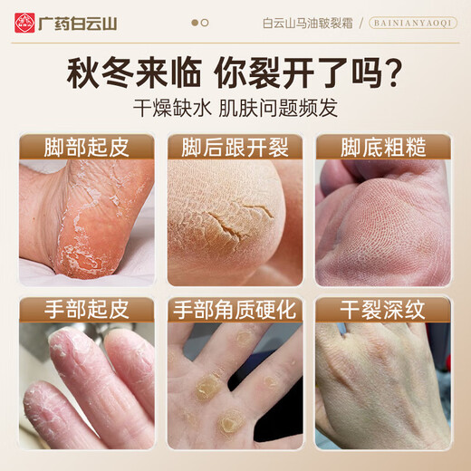 Baiyunshan Horse Oil Cracked Foot Cream 150g Cracked Foot Cream Repair cracked and cracked heels, repair peeling skin, moisturize and moisturize men and women