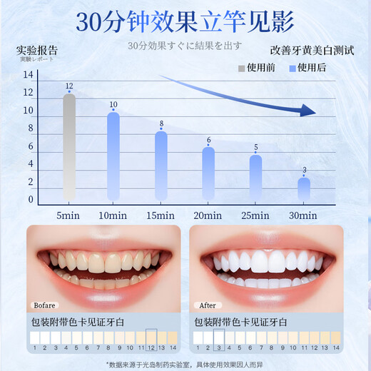 Light Island made tooth patch whitening teeth and yellowing artifact quickly whitening and gentle without sour teeth 2 boxes