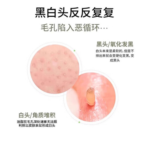 Scrape away blackheads. Portable blackhead scraper. Manual acne facial cleansing hair follicles and pores. Blackhead spatula scraper. Small blackhead spatula for face shaving. Portable. 1 pack. Scrape away blackheads + say goodbye to strawberry nose. Mini beauty spatula.