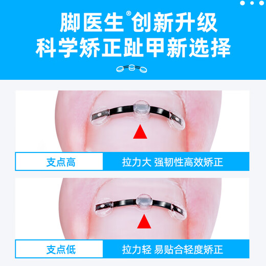 Foot doctor foot fixator, paronychia corrector, ingrown toenail special nail patch, toenail long flesh